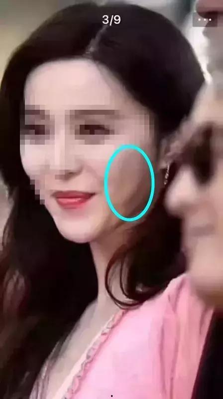 明星都做线雕,揭秘线雕美容的神奇魅力